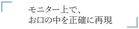 モニター上でお口の中を正確に再現